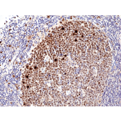 Immunohistochemical staining of formalin fixed and paraffin embedded human tonsil tissue sections, using anti-Ki-67 Rabbit Monoclonal Antibody (Clone RM360) at a 1:1000 dilution.
