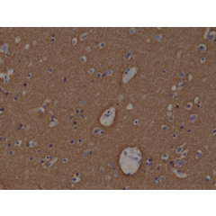Immunohistochemical staining of formalin fixed and paraffin embedded human brain tissue section using anti-Syntaxin-1A rabbit monoclonal antibody (Clone RM367) at a 1:1000 dilution.