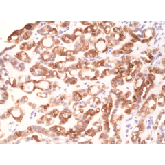 Immunohistochemical staining of formalin fixed and paraffin embedded human thyroid tissue section using anti-TPO rabbit monoclonal antibody (Clone RM368) at a 1:1000 dilution.