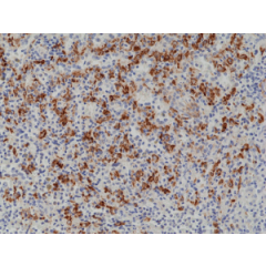 Immunohistochemical staining of formalin fixed and paraffin embedded human spleen tissue section using anti-CD163 rabbit monoclonal antibody (Clone RM371) at a 1:1000 dilution.