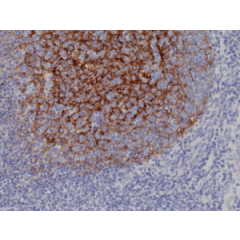 Immunohistochemical staining of formalin fixed and paraffin embedded human tonsil tissue section using anti-CD21 rabbit monoclonal antibody (Clone RM372) at a 1:1000 dilution.