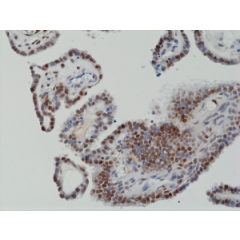 Immunohistochemical staining of formalin fixed and paraffin embedded human thyroid tissue section using anti-c-Fos rabbit monoclonal antibody (Clone RM374) at a 1:1250 dilution.