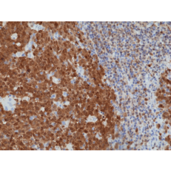 Immunohistochemical staining of formalin fixed and paraffin embedded human tonsil tissue section using anti-BOB-1/OBF-1 rabbit monoclonal antibody (Clone RM378) at a 1:1250 dilution.