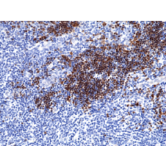 Immunohistochemical staining of formalin fixed and paraffin embedded human thymus tissue section using anti-TdT rabbit monoclonal antibody (Clone RM379) at a 1:200 dilution.