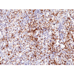 Immunohistochemical staining of formalin fixed and paraffin embedded human spleen tissue section using anti-CD61 rabbit monoclonal antibody (Clone RM382) at a 1:500 dilution.