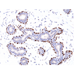 Immunohistochemical staining of formalin fixed and paraffin embedded human Breast tissue section using anti-p63 rabbit monoclonal antibody (Clone RM383) at a 1:100 dilution.