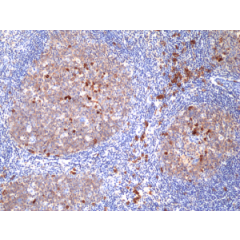 Immunohistochemical staining of formalin fixed and paraffin embedded human tonsil tissue section using anti-CD38 rabbit monoclonal antibody (Clone RM388) at a 1:100 dilution.