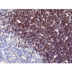 Immunohistochemical staining of formalin fixed and paraffin embedded human thymus tissue section using anti-CD1a rabbit monoclonal antibody (Clone RM393) at a 1:100 dilution.