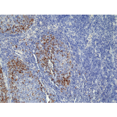 Immunohistochemical staining of formalin fixed and paraffin embedded human tonsil tissue section using anti-TOP2A rabbit monoclonal antibody (Clone RM 394) at a 1:100 dilution.