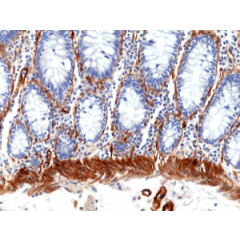 Immunohistochemical staining of formalin fixed and paraffin embedded human colon tissue section using anti-CALD1 rabbit monoclonal antibody (Clone RM396) at a 1:100 dilution.