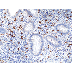 Immunohistochemical staining of formalin fixed and paraffin embedded human appendix tissue section using anti-CD8a rabbit monoclonal antibody (Clone RM397) at a 1:100 dilution.