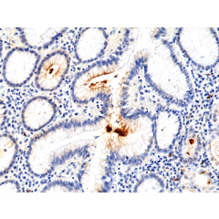 Immunohistochemical staining of formalin fixed and paraffin embedded human stomach using Anti-H.Pylori Rabbit Monoclonal Antibody (Clone RM400) at a 1:100 dilution.