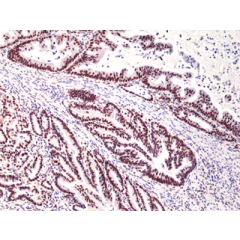 Immunohistochemical staining of formalin fixed and paraffin embedded human thymus using Anti-CD28 Rabbit Monoclonal Antibody (Clone RM404) at a 1:200 dilution.