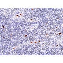 Immunohistochemical staining of formalin fixed and paraffin embedded human tonsil tissue section using Anti-CD23 Rabbit Monoclonal Antibody (Clone RM406) at a 1:200 dilution.