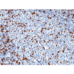 Immunohistochemical staining of formalin fixed and paraffin embedded human tonsil tissue section using Anti-MPO Rabbit Monoclonal Antibody (Clone RM407) at a 1:100 dilution.