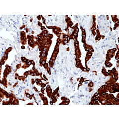 Immunohistochemical staining of formalin fixed and paraffin embedded human tonsil section using Anti-CD14 Rabbit Monoclonal Antibody (Clone RM415) at a 1:250 dilution.
