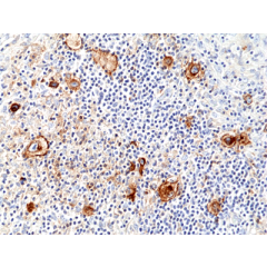 Immunohistochemical staining of formalin fixed and paraffin embedded human tonsil tissue section using anti-CD278 rabbit monoclonal antibody (Clone RM417) at a 1:100 dilution.