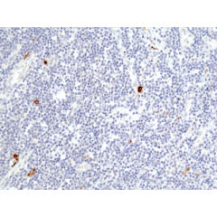 anti-Granzyme B (human), Rabbit Monoclonal (RM441)