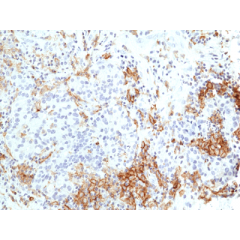 anti-TIM3 (Hepatitis A Virus Cellular Receptor 2), Rabbit Monoclonal (RM448)