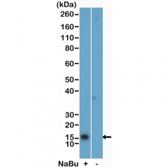 anti-Acetyl-Histone H2B (Lys5), Rabbit Monoclonal (RM455)