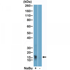 anti-Acetyl-Histone H2B (Lys11), Rabbit Monoclonal (RM456)