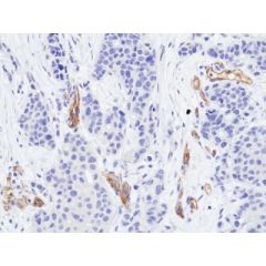 anti-VEGFR2 (human), Rabbit Monoclonal (RM515)