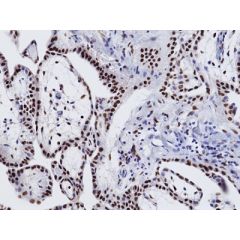 anti-WT1 (human), Rabbit Monoclonal (RM516)