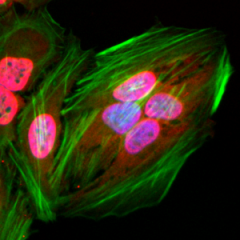 Immunocytochemical staining of HeLa cells using Anti-Acetylated Lysine antibody (RM101) (red). Actin filaments was labeled with fluorescein phalloidin (green), and nucleus stained with DAPI (blue).