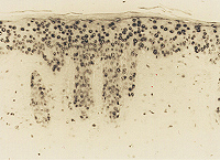 Immunohistochemical staining of epidermis from hairless mouse by chronic UVB irradiation after 4 weeks of treatment using anti-8-OHdG, mAb (N45.1).
