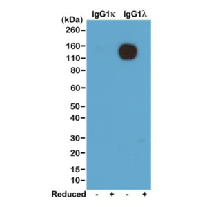 An ELISA of Helicobacter Pylori proteins using Anti-HP-NAP Rabbit Monoclonal Antibody Clone RM414. The plate was coated with 1 ug/mL of CagA, OMP, Urease, or HP-NAP of H. Pylori. A serial dilution of RM414 was used as the primary antibody. An alkaline pho