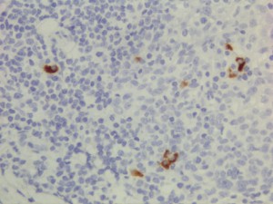 Sandwich ELISA using RM118 as the capture antibody, and Biotinylated anti-human light chains ( kappa+ lambda) antibody RM129 as the detection antibody, followed by an AP conjugated streptavidin.