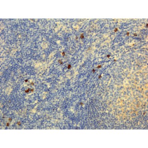 Immunohistochemical staining of formalin fixed and paraffin embedded human lymphoid tissue section using anti-human IgG4 rabbit monoclonal antibody (Clone RM120).