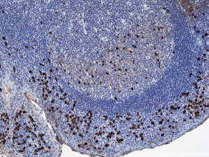 Immunohistochemistry of Human Tonsil Tissue using Anti-Human IgA1 antibody RM124.