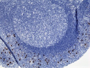 Immunohistochemistry of Human Tonsil Tissue using Anti-Human IgA2 antibody RM125.