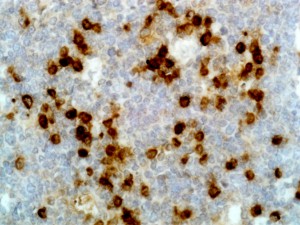 Immunohistochemical staining of formalin fixed and paraffin embedded human tonsil tissue section using anti-human Ig lambda light chain rabbit monoclonal antibody (Clone RM127).