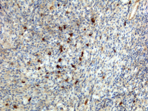 Sandwich ELISA using RM121 as the capture antibody (100ng/well), and Biotinylated anti-human light chains ( kappa+ lambda) antibody RM129 as the detection antibody, followed by an alkaline phosphatase conjugated streptavidin.