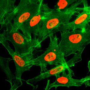 Immunocytochemistry of HeLa cells treated with sodium butyrate, using Acetyl-Histone H3 (Lys14) Rabbit mAb RM130 (red). Actin filaments have been labeled with fluorescein phalloidin (green).