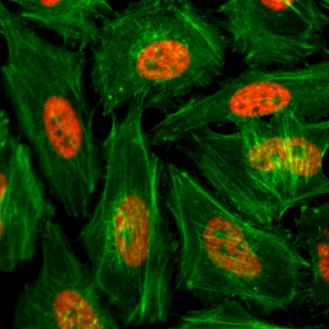 Immunocytochemistry of HeLa cells treated with sodium butyrate, using Monomethyl-Histone H3 (Lys4) Rabbit mAb RM140 (red). Actin filaments have been labeled with fluorescein phalloidin (green).