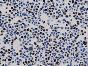 Immunohistochemistry staining of 293T cells expressing His-Tag nuclear protein X, using anti-His-Tag antibody, RM146.