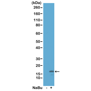 anti-Acetyl-Histone H3 (Lys18), Rabbit Monoclonal (RM166)