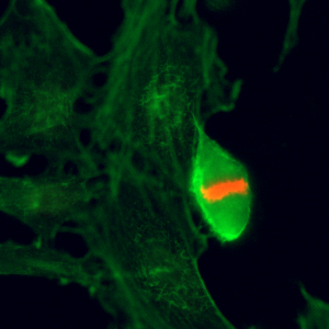 Immunocytochemistry of HeLa cells using Phospho-Histone H3 (Thr3) Rabbit mAb RM159 (red). Actin filaments have been labeled with fluorescein phalloidin (green).