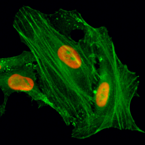 Immunocytochemical staining of HeLa cells treated with sodium butyrate, using anti-Acetyl-Histone H4 (Lys8) Rabbit Monoclonal Antibody (clone RM201) (red). Actin filaments have been labeled with fluorescein phalloidin (green).
