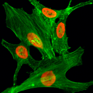 Immunocytochemical staining of HeLa cells treated with sodium butyrate, using anti-Acetyl-Histone H2A.Z (Lys4) Rabbit Monoclonal Antibody (clone RM221) (red). Actin filaments have been labeled with fluorescein phalloidin (green).