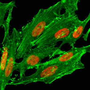 Immunocytochemical staining of HeLa cells treated with sodium butyrate, using anti-Acetyl-Histone H2A.Z (Lys7) Rabbit Monoclonal Antibody (clone RM222) (red). Actin filaments have been labeled with fluorescein phalloidin (green).