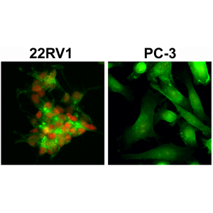 Immunocytochemical staining of 22RV1 and PC-3 cells, using anti-AR-V7 rabbit monoclonal Antibody Clone RM7 (red). Actin filaments have been labeled with fluorescein phalloidin (green).