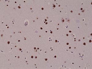 Immunohistochemical staining of formalin fixed and paraffin embedded human brain tissue sections, using rabbit monoclonal anti-5-hmC (clone RM236) antibody.