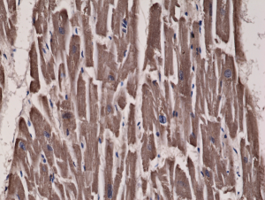 Immunohistochemical staining of formalin fixed and paraffin embedded human heart tissue sections using Anti-Acetyl CoA Carboxylase 1 RM232 at a 1:300 dilution.