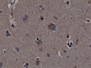 Immunohistochemical staining of formalin fixed and paraffin embedded human cerebral cortex tissue sections using Anti-phospho-Rsk1 (Thr359/Ser363) RM233 at a 1:200 dilution.