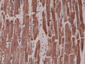 Immunohistochemical staining of formalin fixed and paraffin embedded human heart tissue sections using Anti-Desmin RM234 at a 1:4000 dilution.