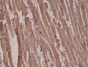 Immunohistochemical staining of formalin fixed and paraffin embedded human heart tissue sections using Anti-alpha-cardiac actin rabbit monoclonal antibody, Clone RM257 at a 1:1000 dilution.